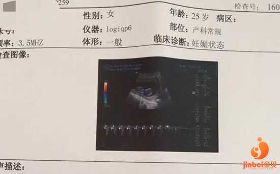 湖北供卵媒体联系方式_【南京公立医院供卵对身体有害吗】顺产女宝，分享一